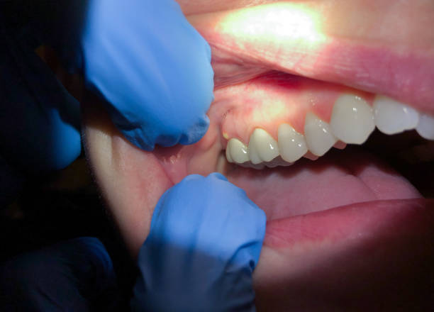 Best Orthodontic Emergency Dentist in Oakland, FL