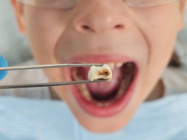 Best Pediatric Emergency Dentist in Oakland, FL